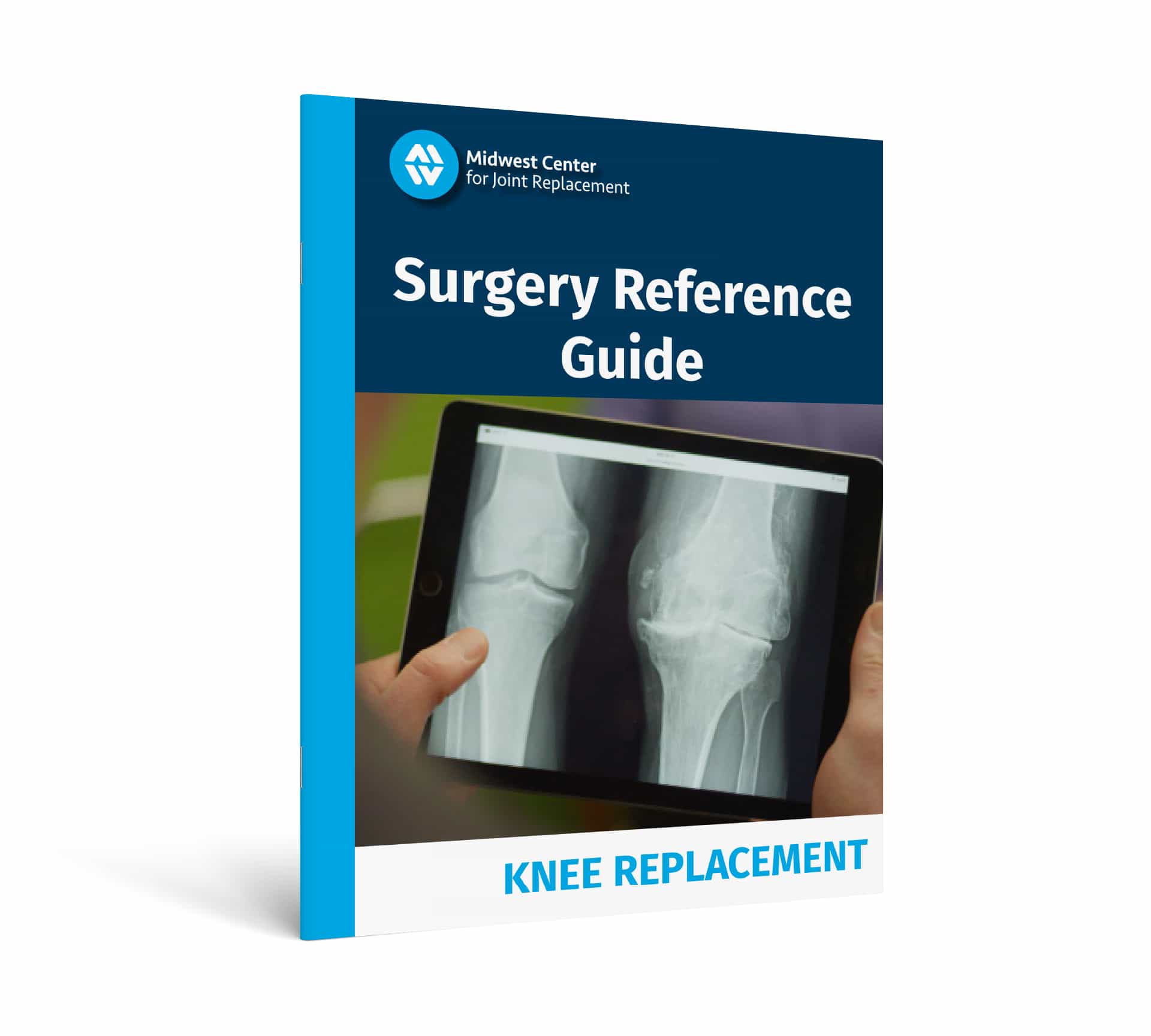 Patient Surgery Guide - Knee 2025
